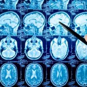 Neurological Rehabilitation Fellowship course in India