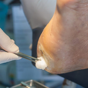 Footcare by a certified doctor